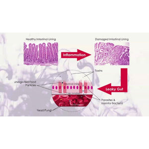 Ayurveda and Auto-Immune Diseases (Ayurveda on Symptoms, Root Causes and Recovery from Thyroid Disorders, IBD, Celiac Disease, Skin Ailments such as Eczema) Educational Videos The Ayurveda Experience