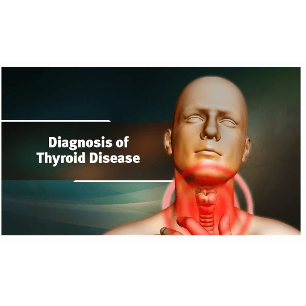 Ayurveda & Thyroid Health (Ayurveda on Root Causes of Thyroid, Diagnosis of Thyroid and Thyroid Diet) Educational Videos The Ayurveda Experience 